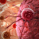 cancer-cells