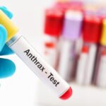 896-504-virus-antraks