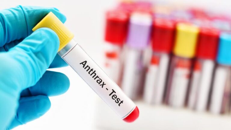 896-504-virus-antraks