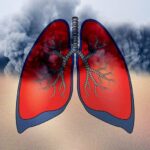 IMAGE_15662502_4000_0