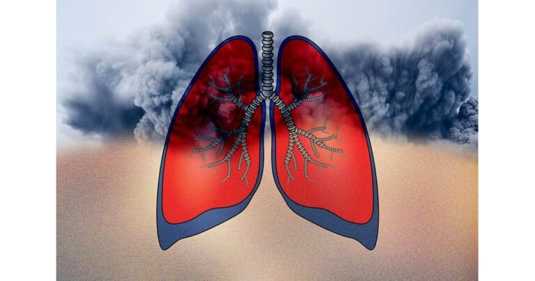 IMAGE_15662502_4000_0