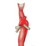 7-oesophagus-asklepios-medical-atlas